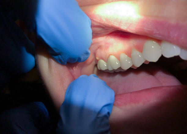 Best Emergency Treatment for Jaw Pain or Injury in Gifford, FL